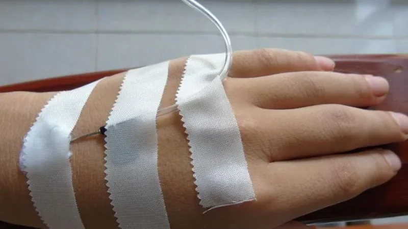 Tổng hợp hình ảnh truyền nước độc đáo tại cánh tay (2)