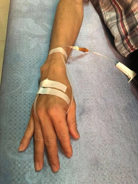 Những hình ảnh truyền nước biển tại tay nam và nữ đầy ấn tượng (6)