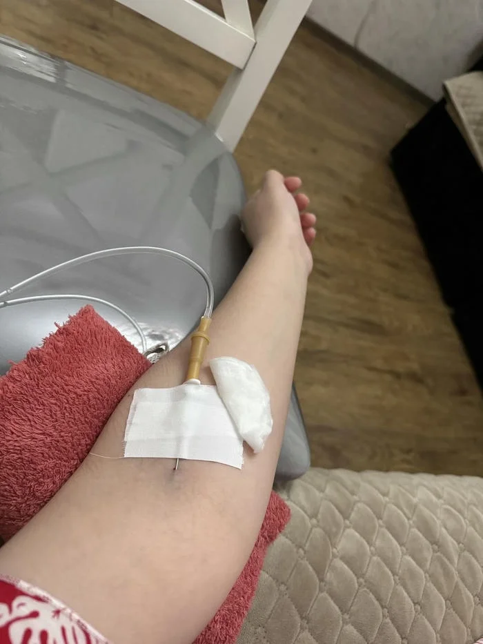 200 Hình ảnh truyền nước biển ở tay nam và nữ chân thật 100%