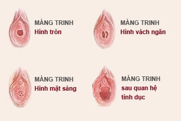 Hình 84 trong bộ sex gái còn trinh