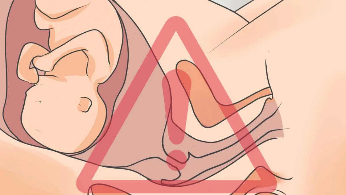 Rỉ ối bao lâu thì sinh?